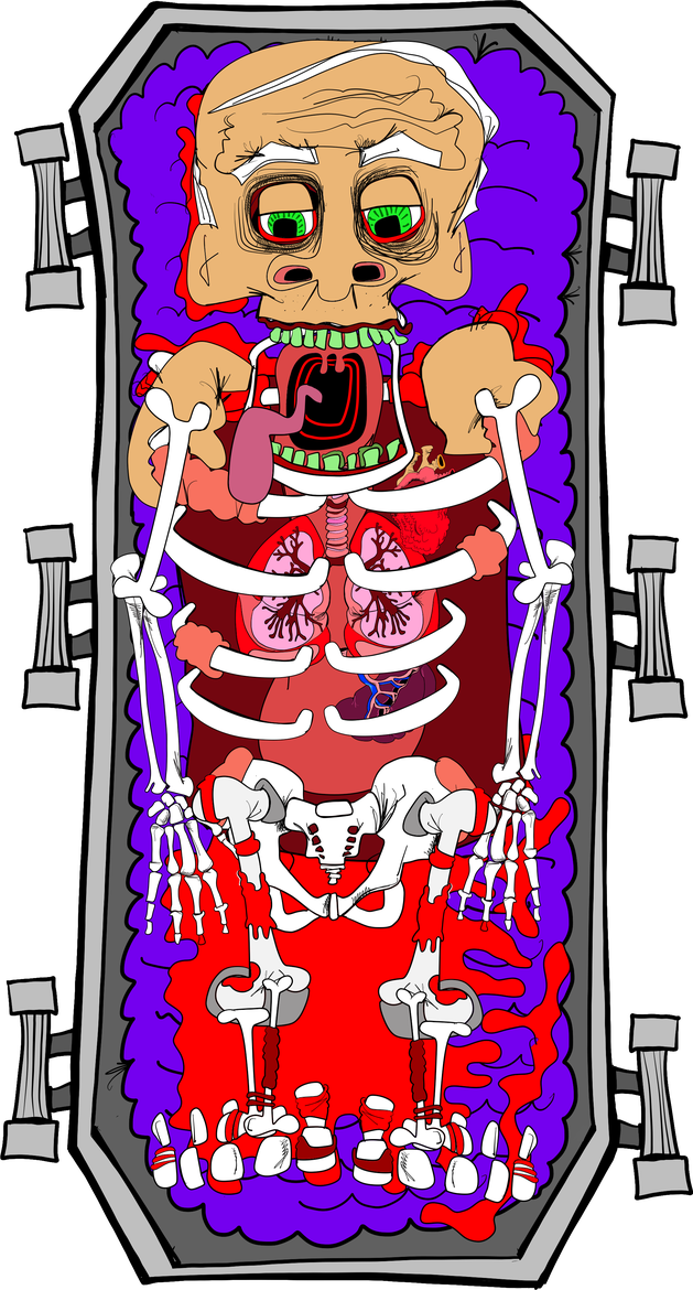 An open coffin containing a body with exposed organs