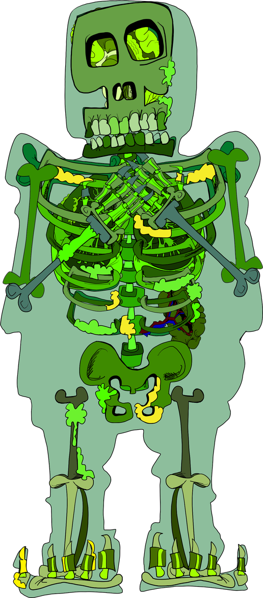 Green decaying remains with exposed bones and organs