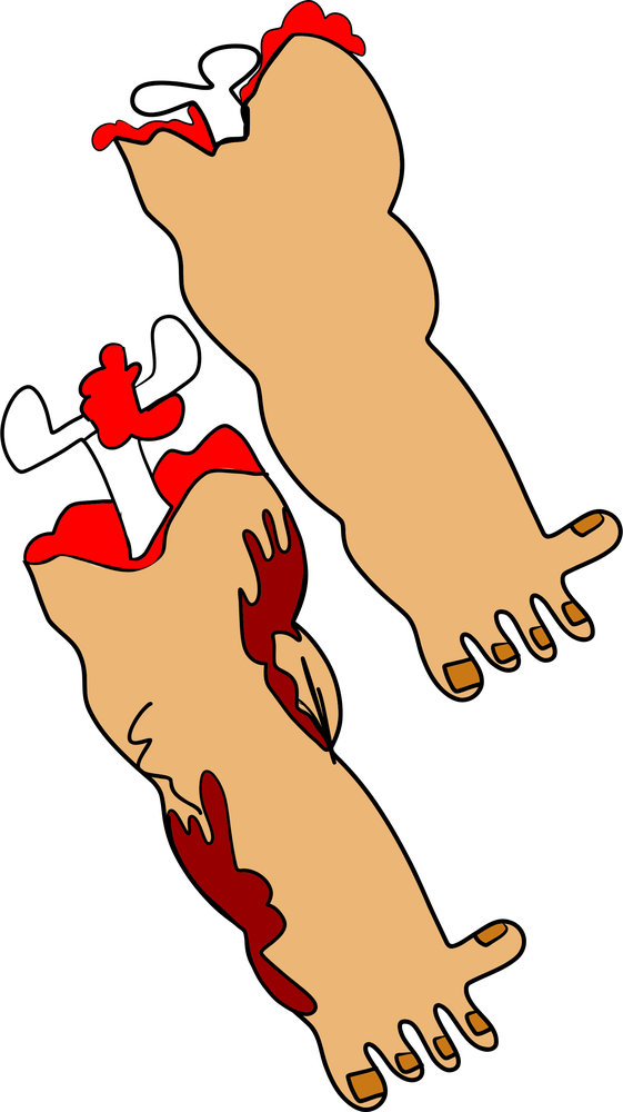 Two stolen limbs with exposed bones